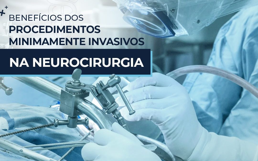 Benefícios dos procedimentos minimamente invasivos na neurocirurgia Dr Victor Emmanuel