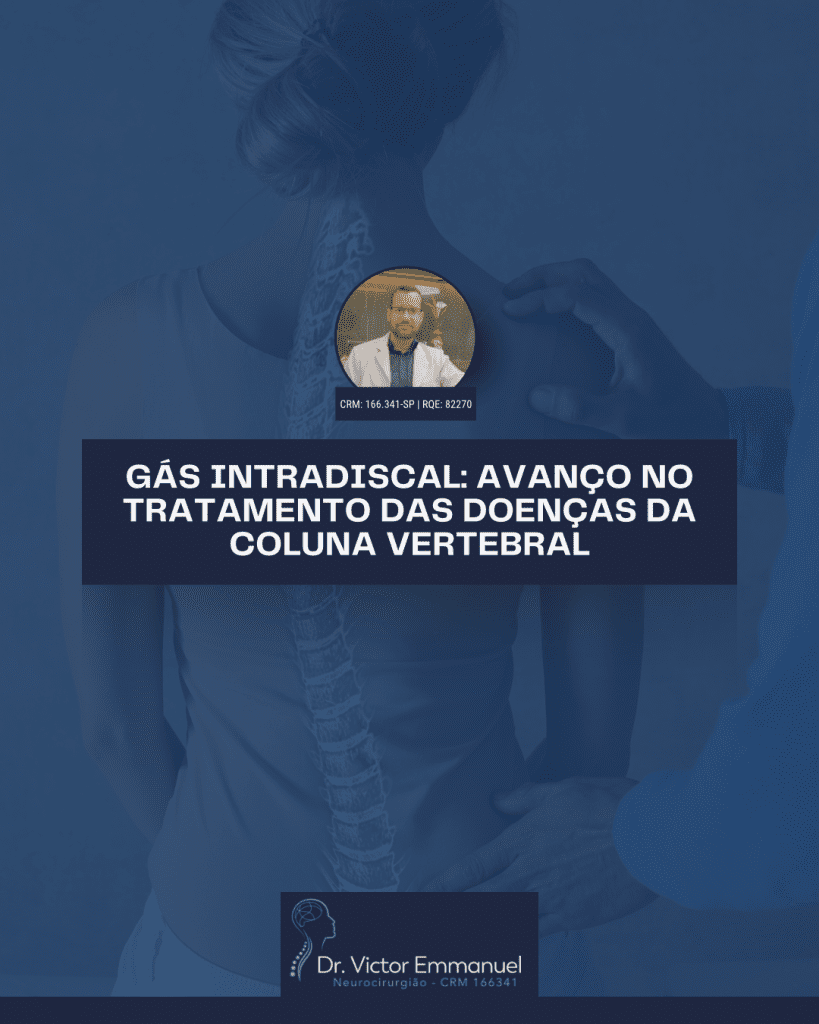 Gás Intradiscal para avanços no tratamento da coluna.