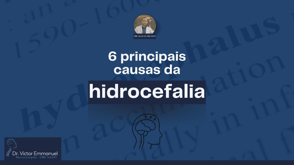 Hidrocefalia