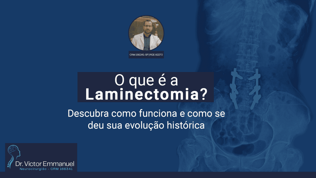 O que é a laminectomia